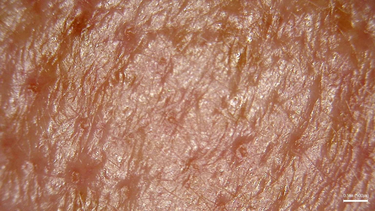 Obraz multispektralny używany w diagnostyce skóry i włosów