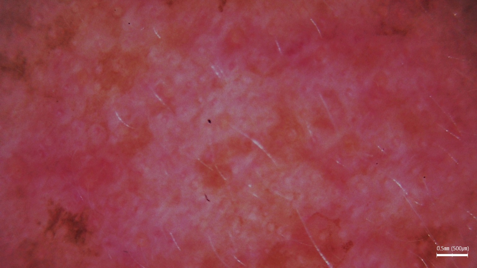 Lumiscan Hair & Body w trakcie diagnostyki skóry i włosów u klienta