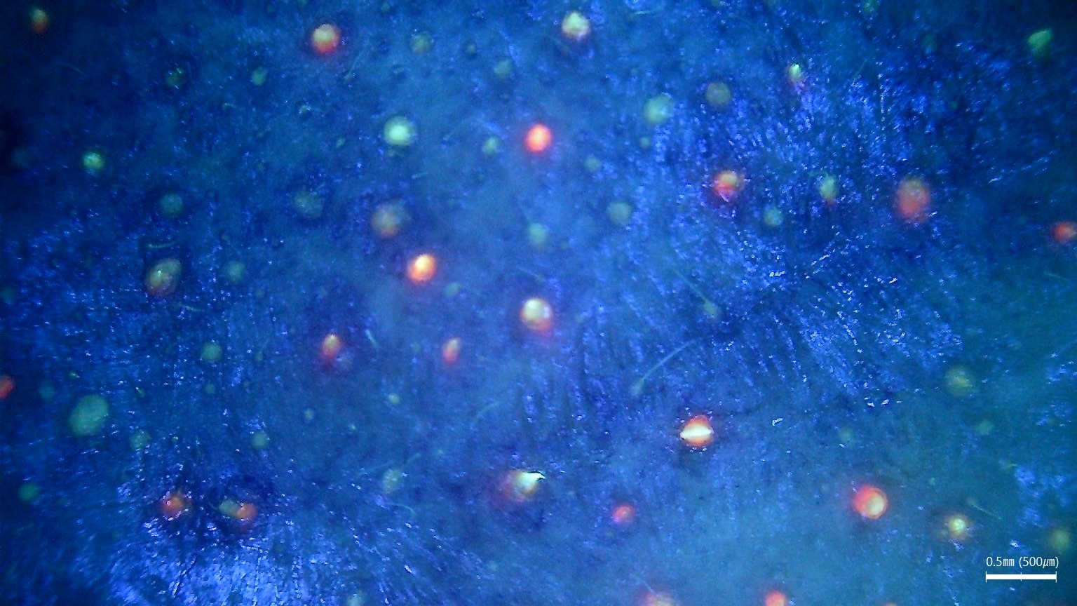 Badanie skóry głowy jako element diagnostyki skóry i włosów