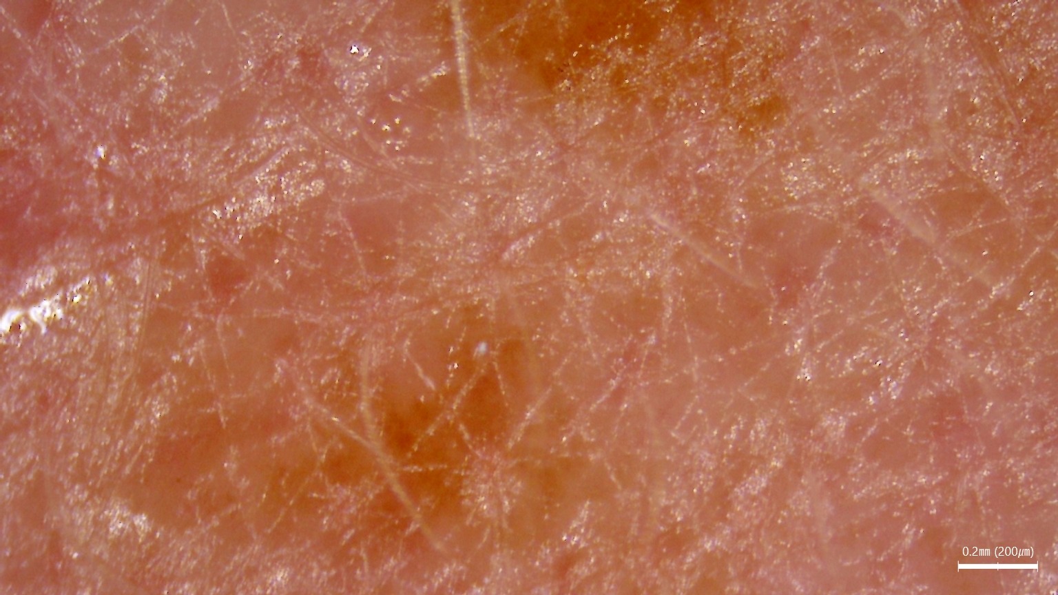 Trycholog wykonujący diagnostykę skóry i włosów z wykorzystaniem kamery