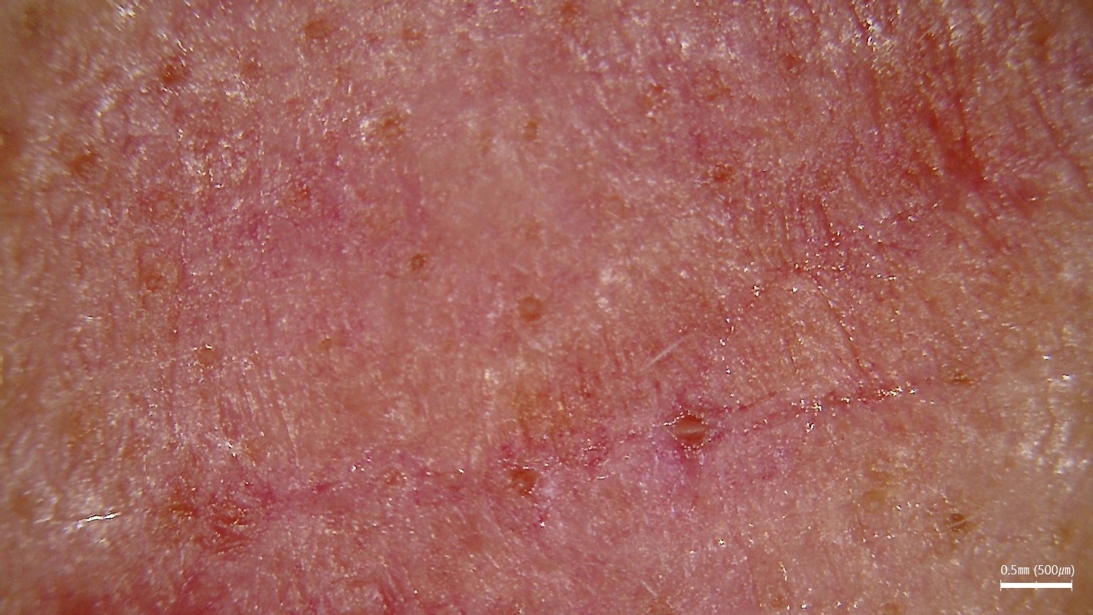 Analiza mieszków włosowych podczas diagnostyki skóry i włosów