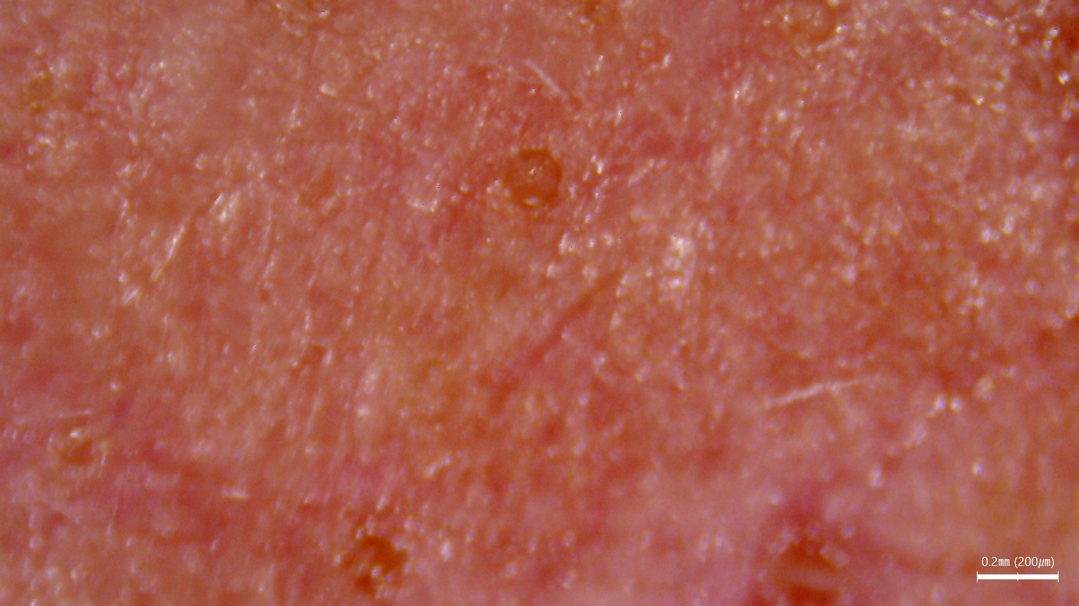 Diagnostyka skóry i włosów z użyciem światła UV w gabinecie