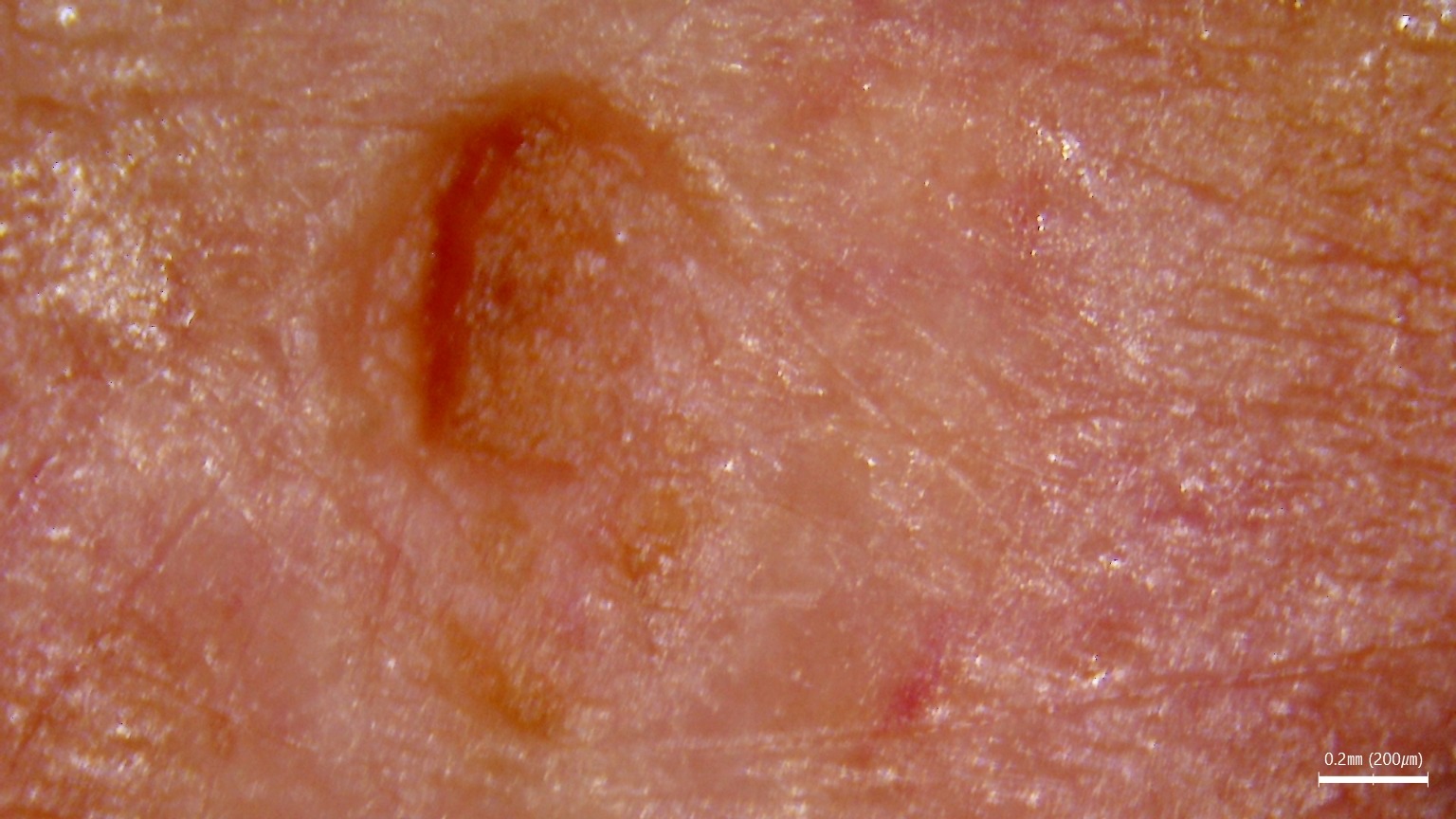 Zbliżenie na strukturę włosa analizowaną w diagnostyce skóry i włosów