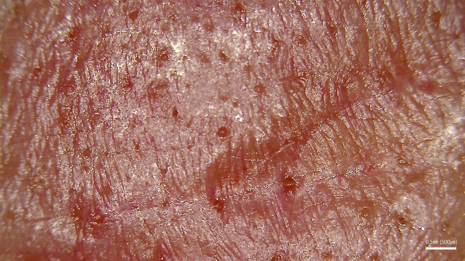 Diagnostyka skóry i włosów wykorzystująca różne typy światła LED