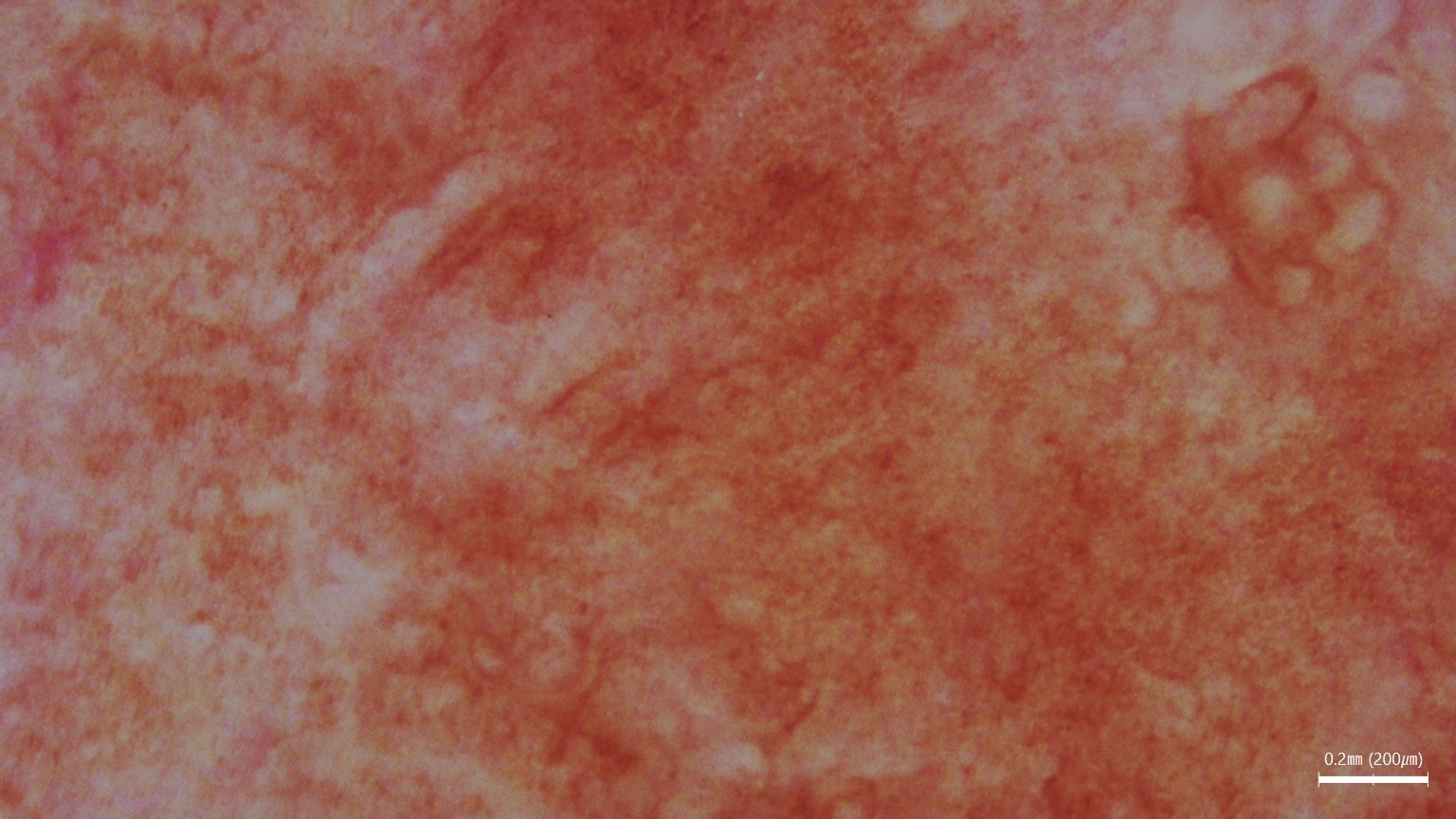 Diagnostyka skóry i włosów z wykorzystaniem powiększenia 200×