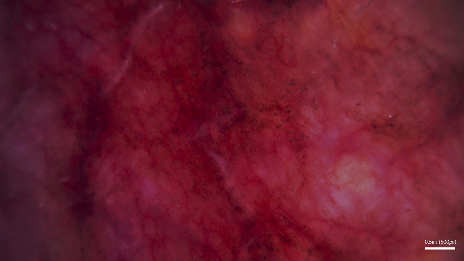 Ocena stopnia przetłuszczania podczas diagnostyki skóry i włosów