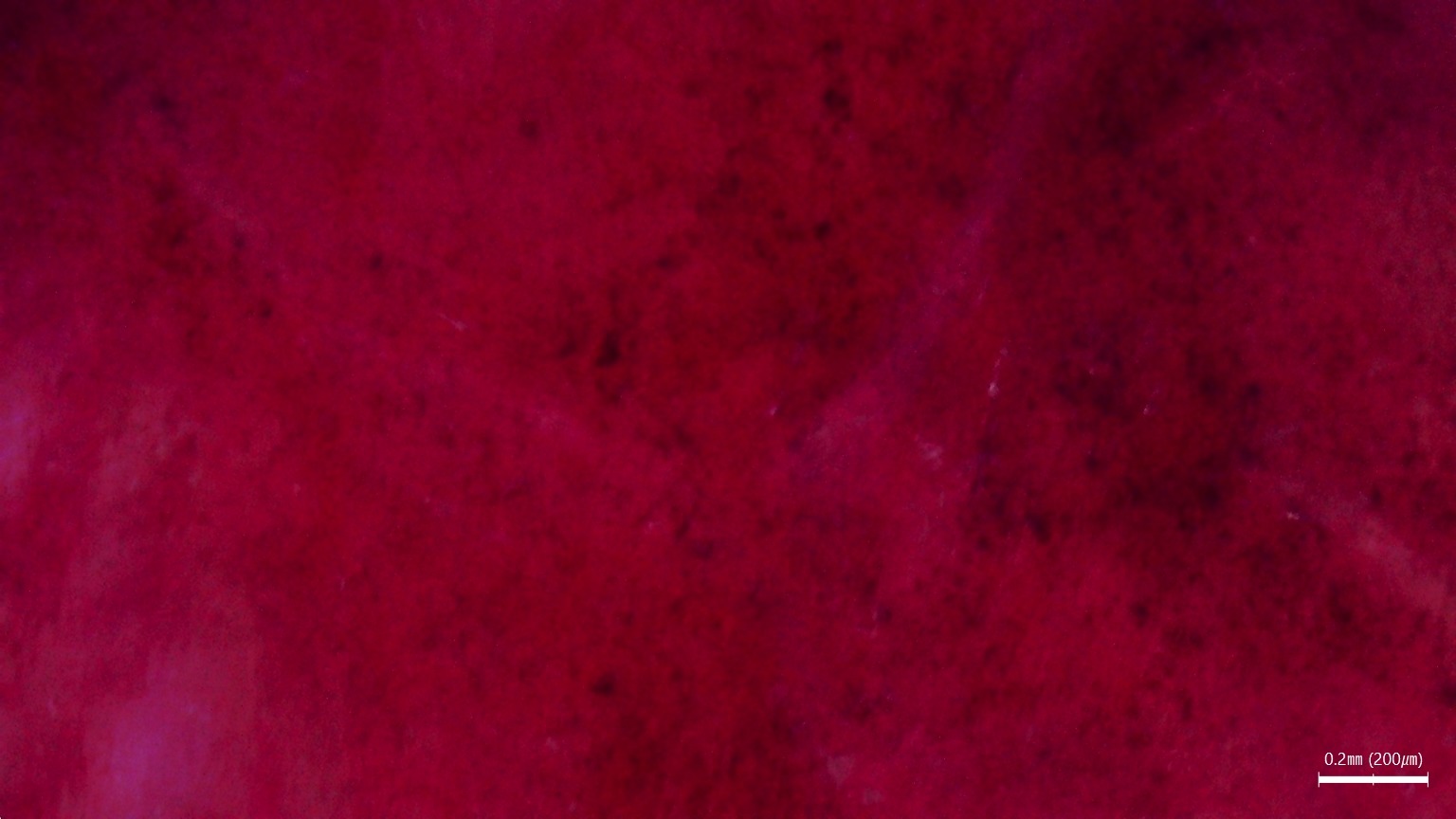 Szczegółowe badanie łusek włosa podczas diagnostyki skóry i włosów