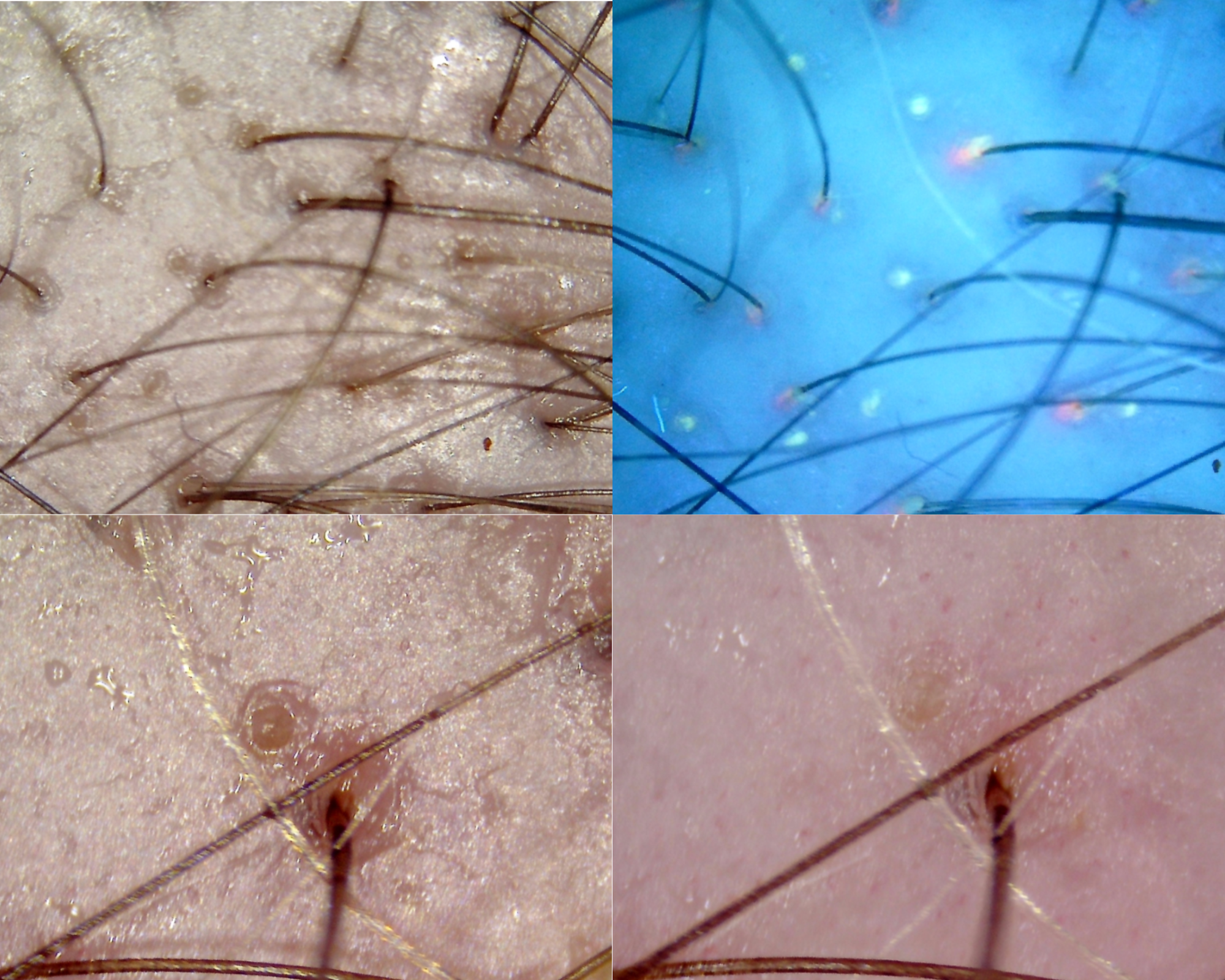 Diagnostyka skóry i włosów ukazująca kondycję mieszków włosowych