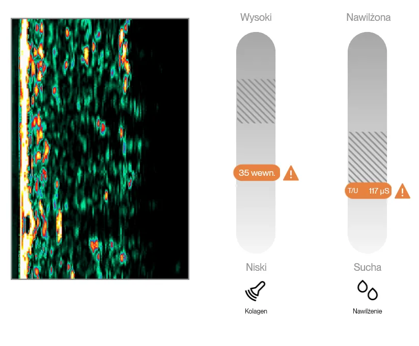 Ekran wyniku DermaLab Aesthetic: obraz warstw skóry i skale parametrów