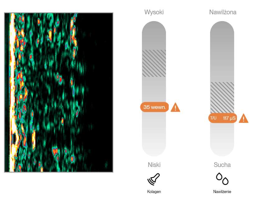 Interpretacja wyników pomiarów skóry – kosmetolog analizuje dane z urządzenia Dermalab Aesthetic