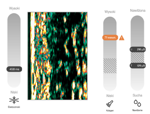 Personalizacja terapii skóry twarzy na podstawie diagnostyki DermaLab Aesthetic – przykład indywidualnego planu pielęgnacji