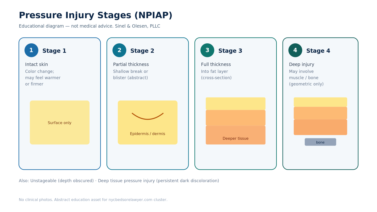 Abstract NPIAP pressure injury stages 1–4 educational diagram — no clinical photos