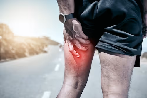 bildet viser en mannlig løper på asfalt i kveldslys som holder seg til baksiden av låret opp mot sitteknuten. Området han holder på er farget rødt for å signalisere smerter, kanskje relatert til proksimal hamstringstendinopati, hamstringsmerter, hamstringstrekk eller en annen form for hofte- og lårplage.