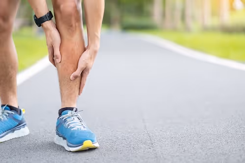 Løper holder seg på leggen med smerter - nærbilde av bein med løpesko som illustrerer medialt tibialt stress syndrom (beinhinnebetennnelse) og leggsmerter under løping på asfalt.