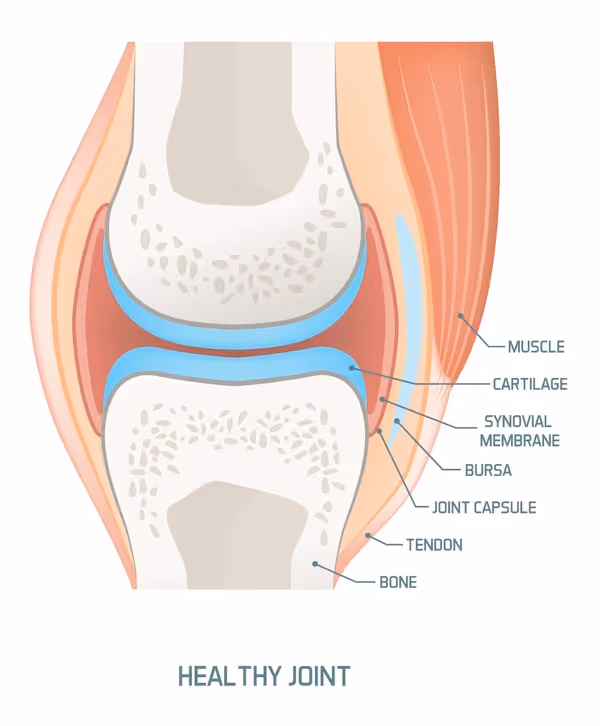 Medisinsk illustrasjon av et friskt kneledd i tverrsnitt. Bildet viser hvordan lårbeinet (femur) og leggbenet (tibia) møtes, med tilhørende brusk (lyseblått lag) på enden av hver knokkel. Rundt disse ses leddkapselens synoviale membran med leddvæske inni.