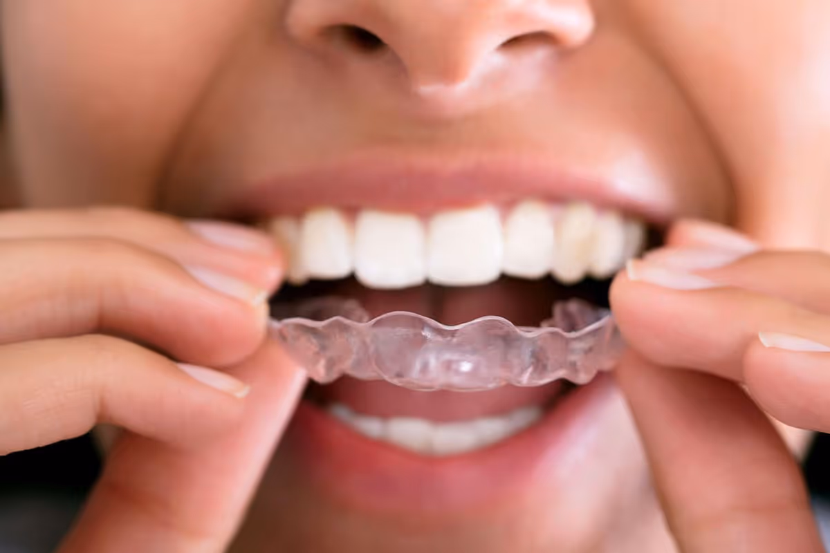 Sleep Apnoea Teeth Grinding