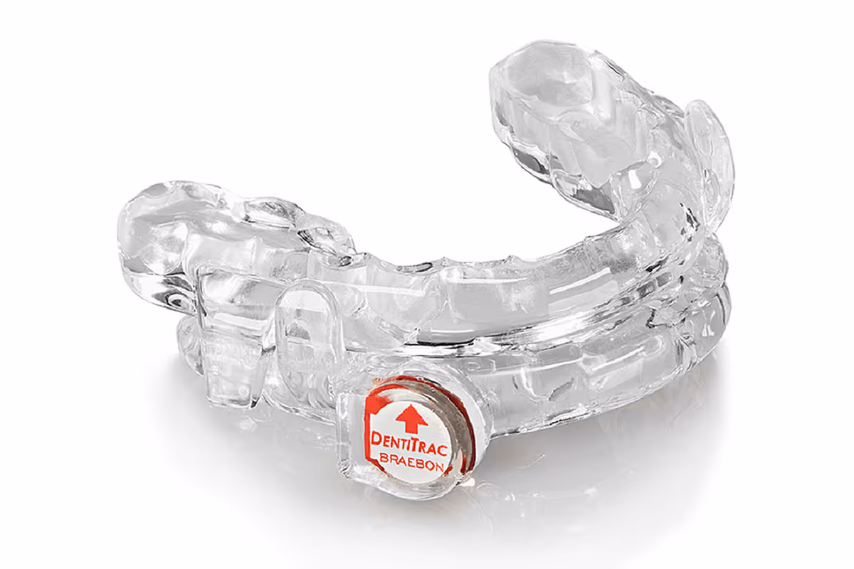 Dr. Stern's New Study on Effectiveness of MAD Oral Appliances for Sleep Apnoea