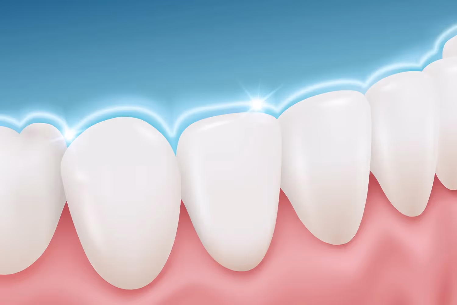Fluoride Treatments in Boulder, CO | Folsom Family Dentistry