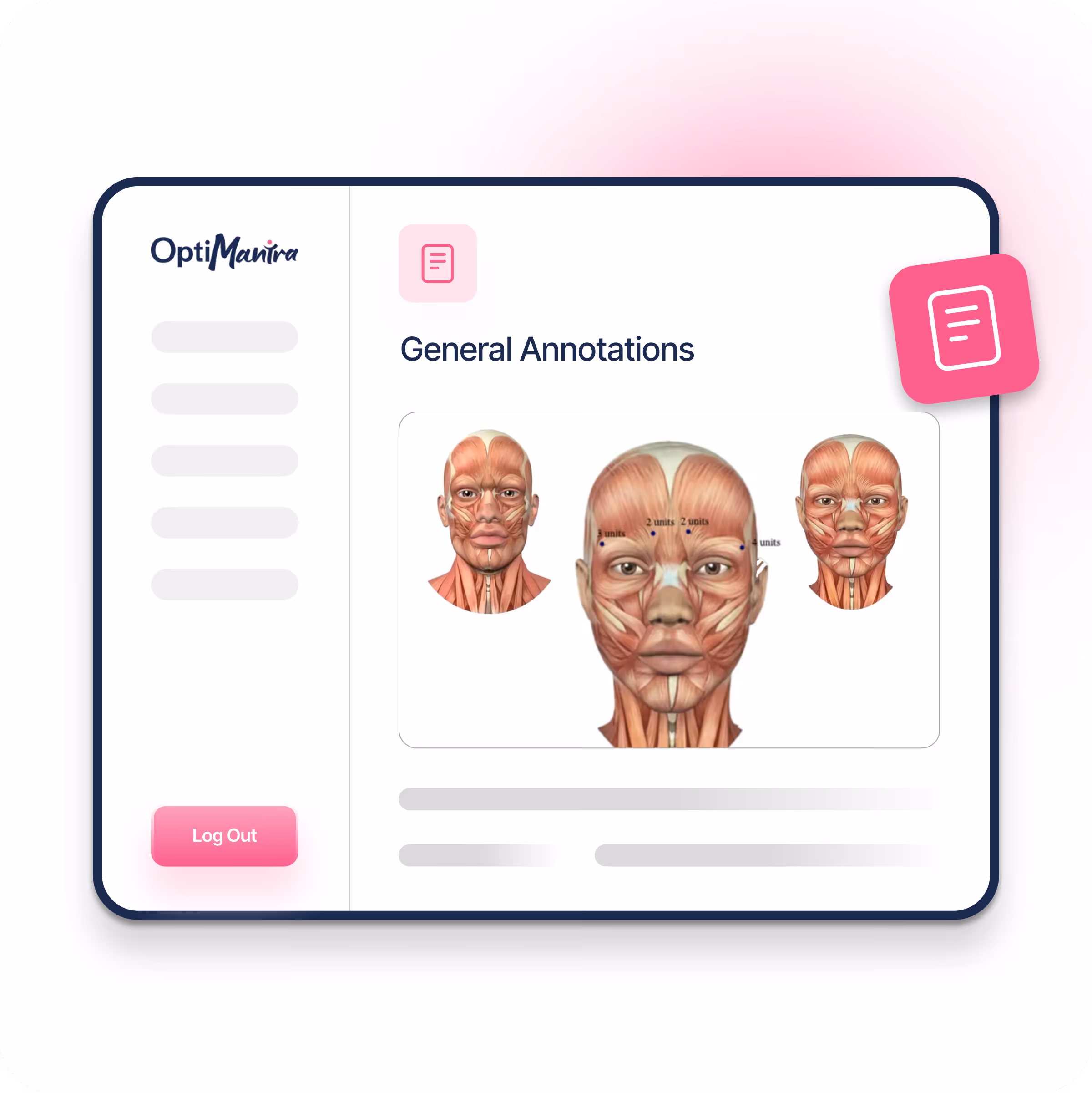 Med Spa Annotatable Images to Record Injections and Quantities