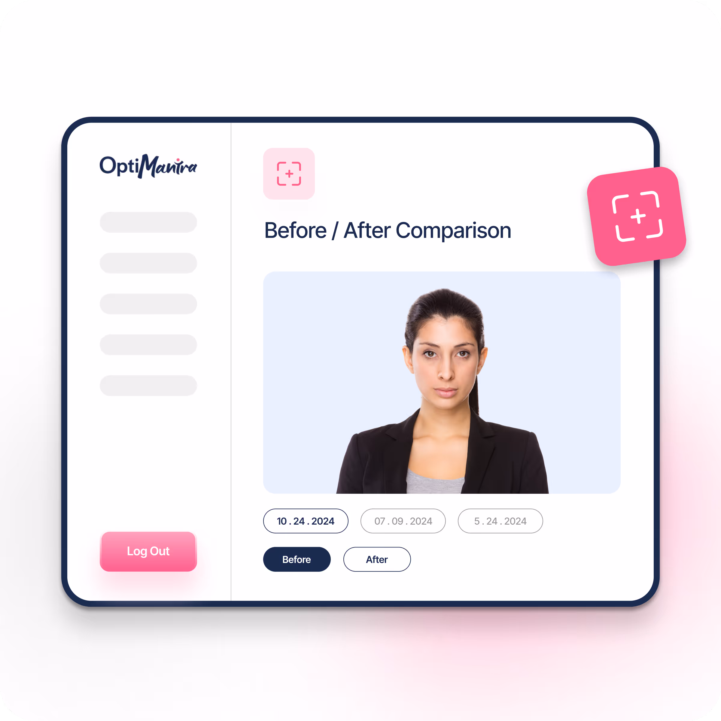 Med Spa Adjustable Before and After Photos