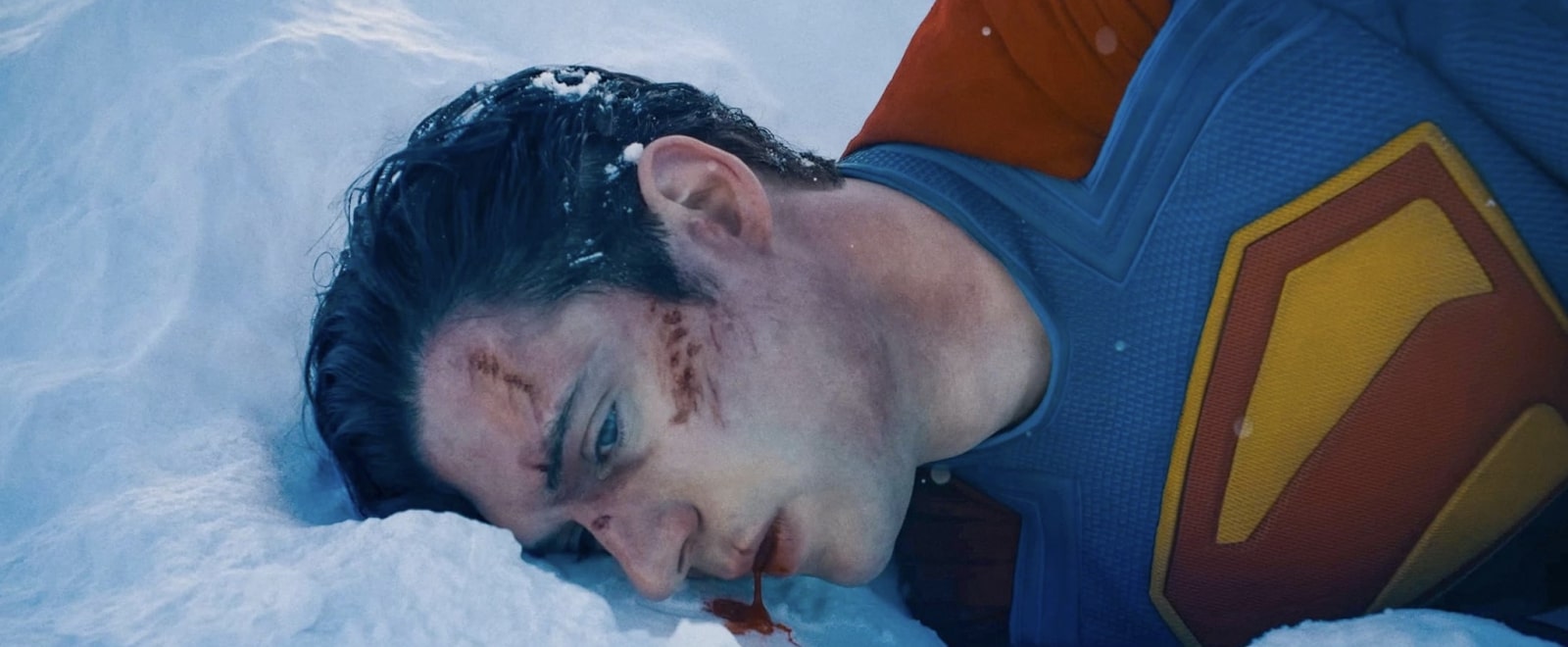 Superman bleeding from his mouth after a fight