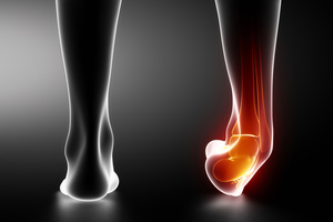 Blog: How to Recover from a High Ankle Sprain?