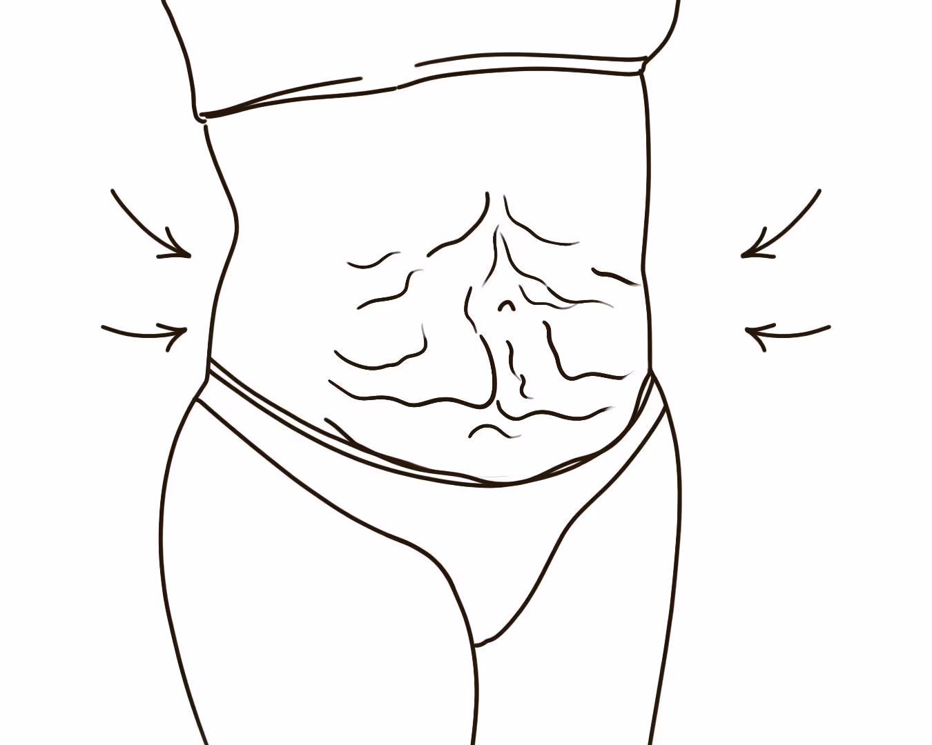 Abdominal Laxity