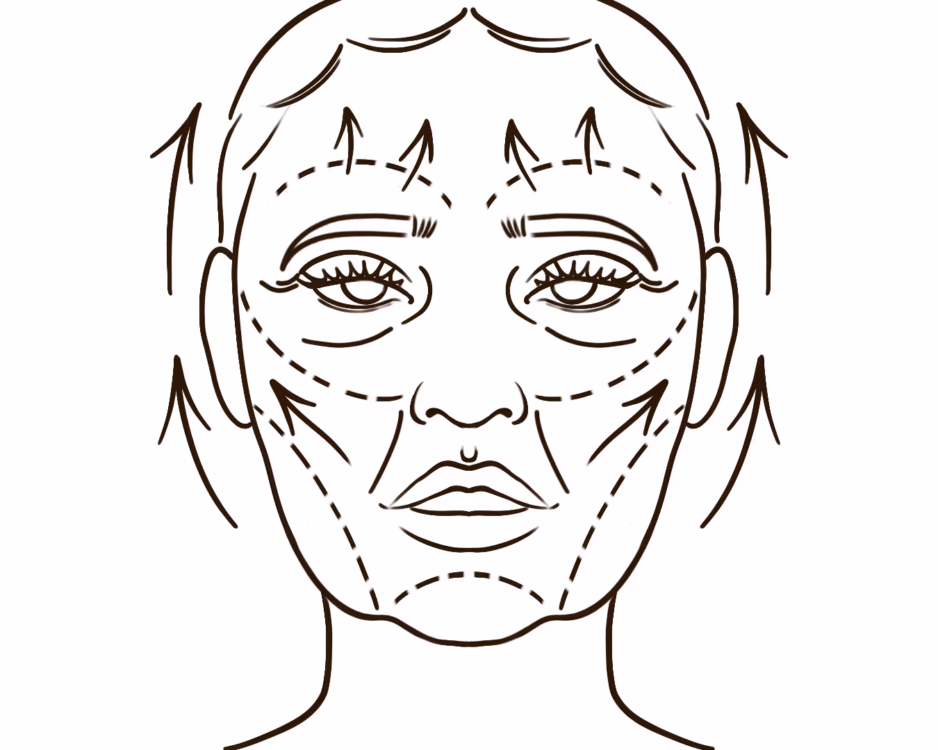 Nasolabial Folds