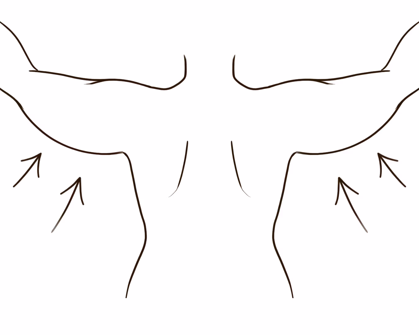 Sagging Skin