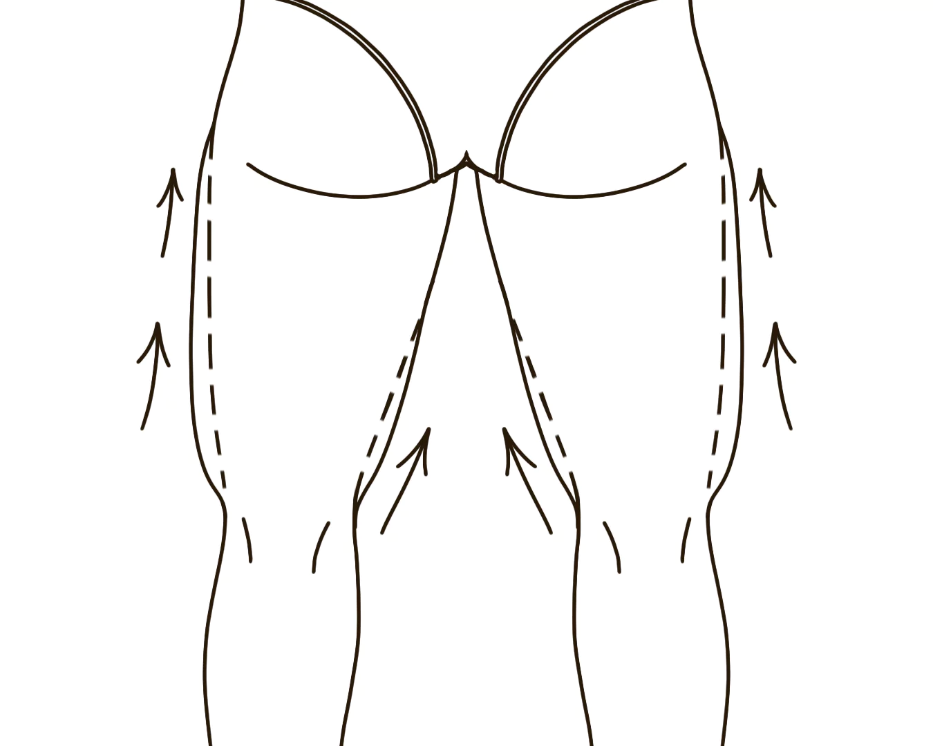 Thigh Sagging