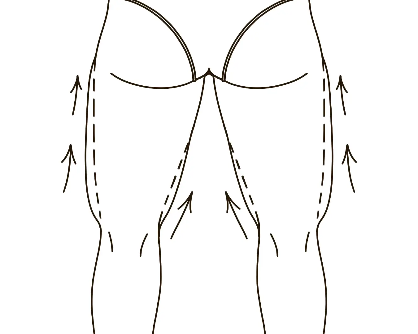 Thigh Sagging