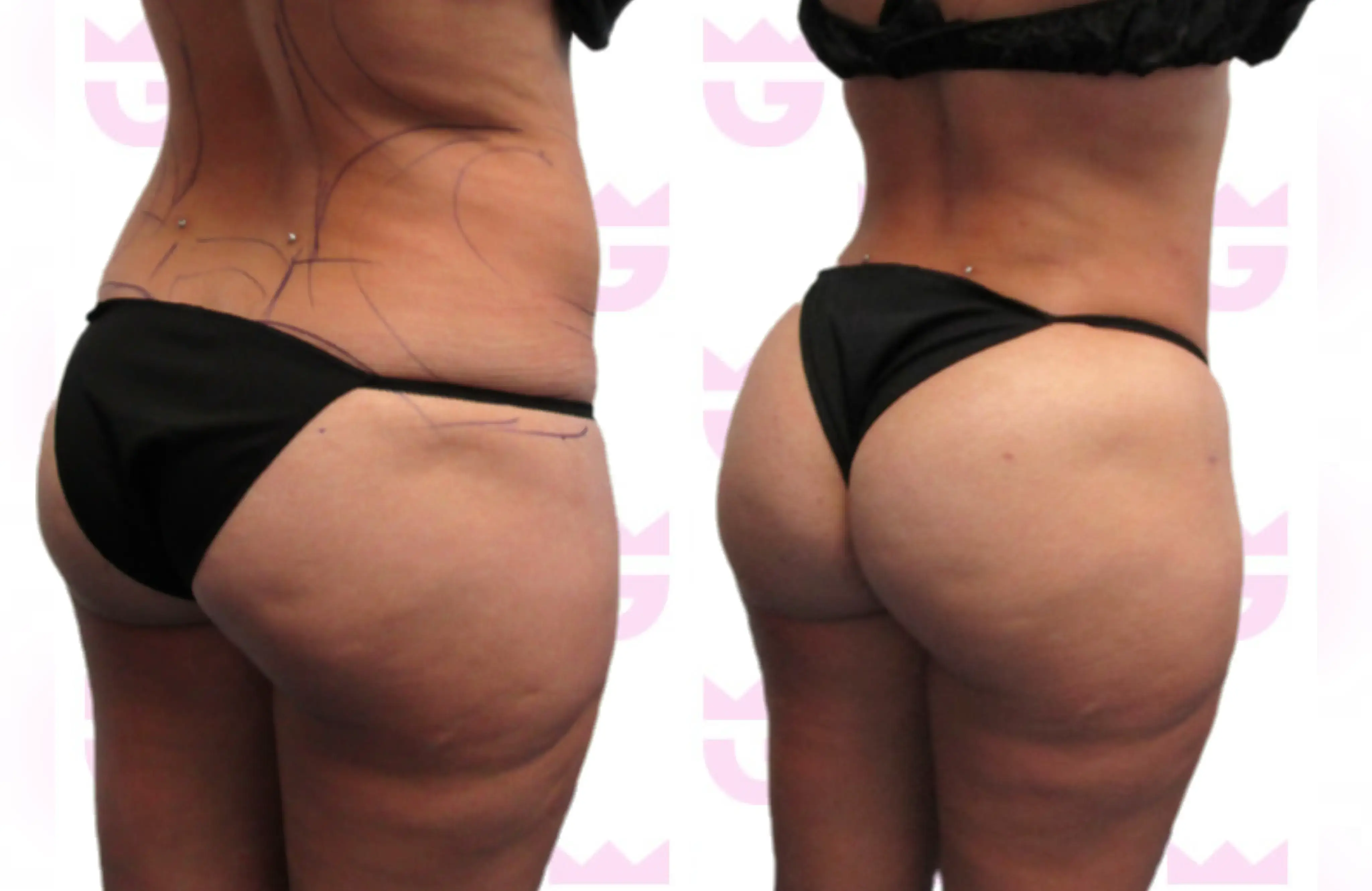 Awake Gruber Booty Gallery