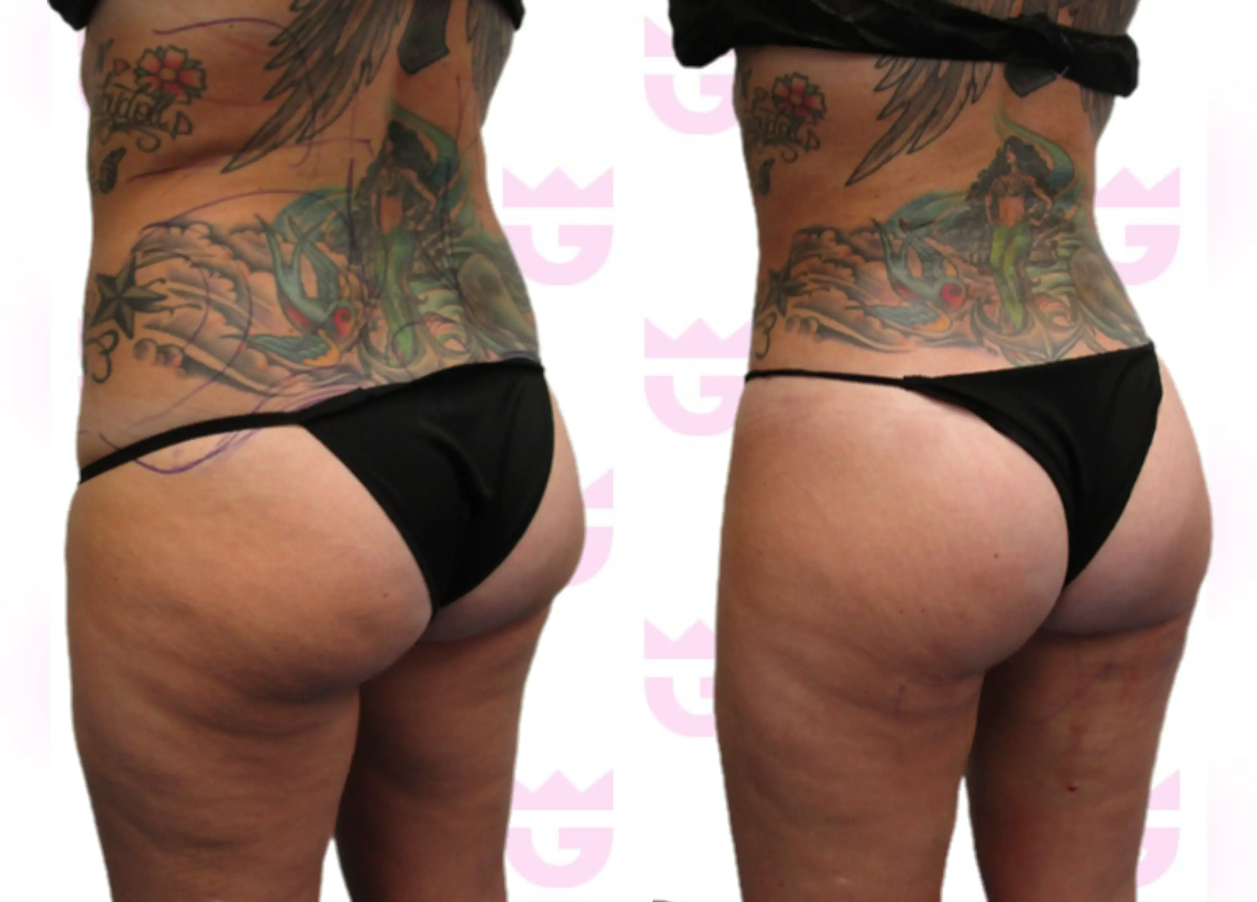 Awake Gruber Booty Gallery