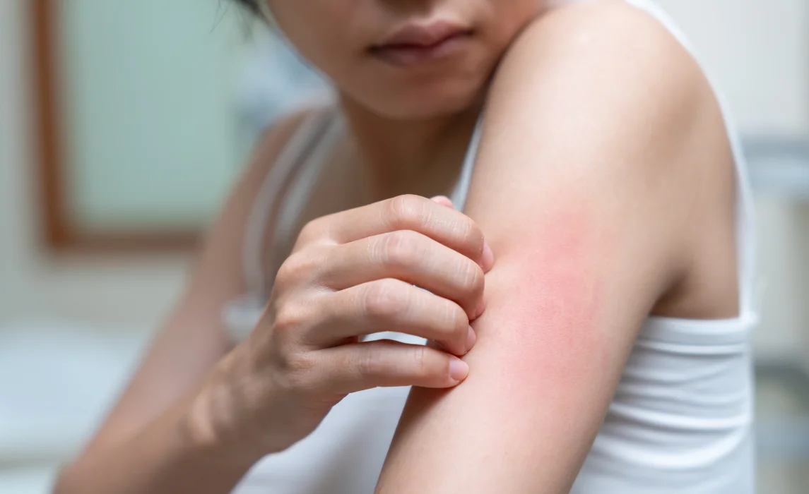 girl itching her arms
