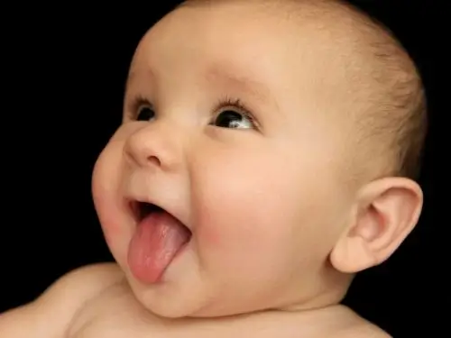 Tongue-Tie (Ankyloglossia): Signs Your Baby Needs Help