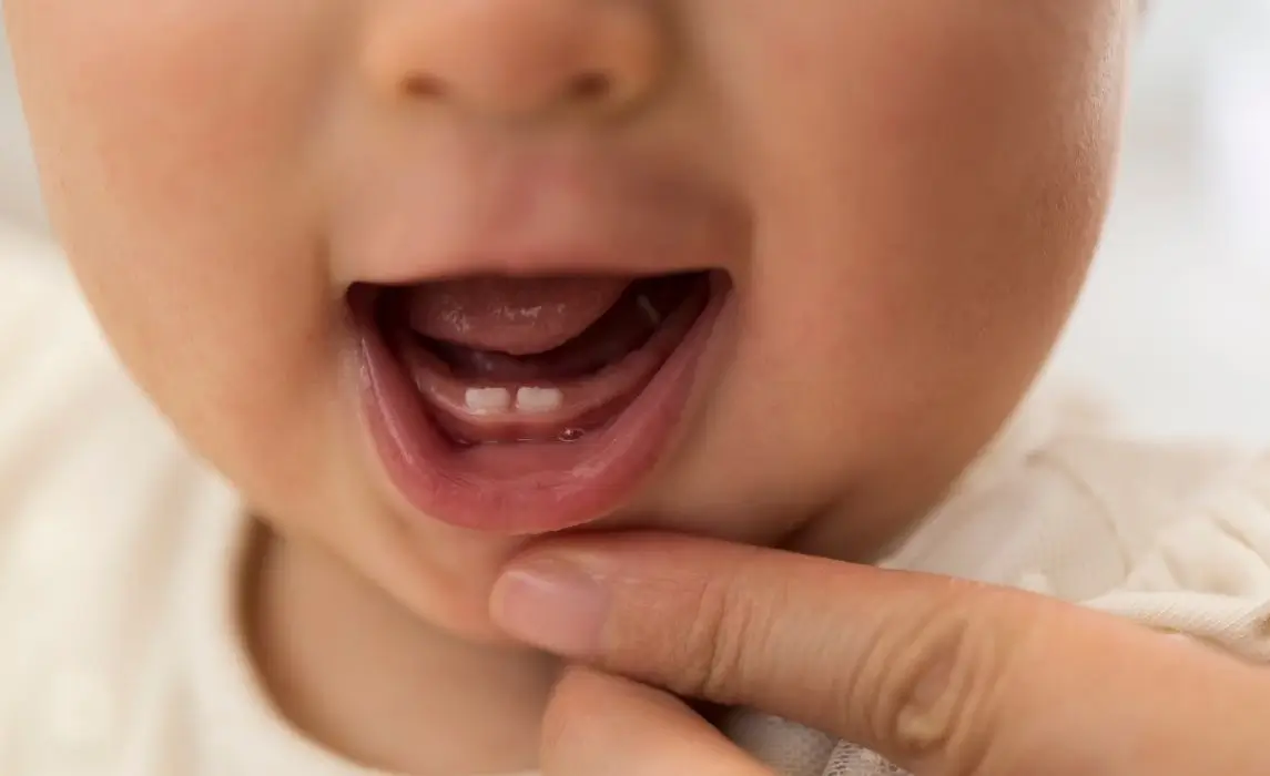 When Do Babies Start Teething? Signs, Symptoms, and Remedies for First Teeth