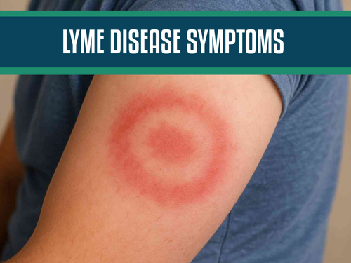 Lyme Disease Symptoms and Causes: Understanding the Early Warning Signs of This Tick-Borne Disease