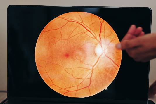 oftalmologo analizando imagen de ojo