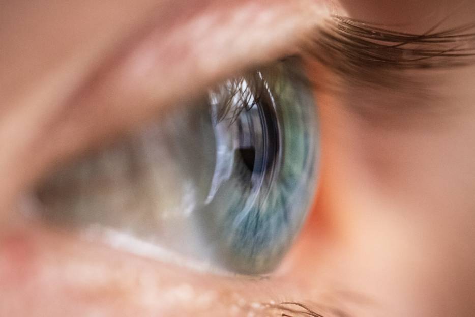 ojo de paciente con membrana epirretiniana