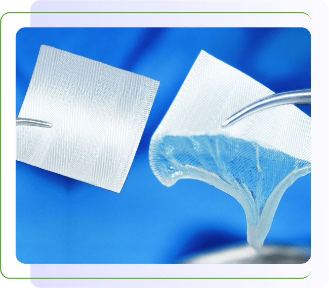 Two small white mesh-like surgical patches held by metal tweezers against a blue background.