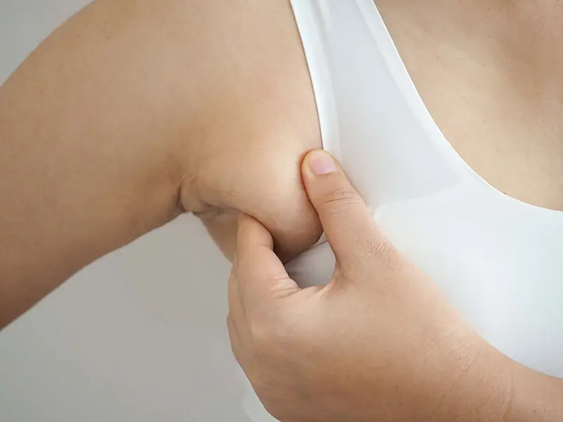 Axillary Breast Tissue in Men & Women