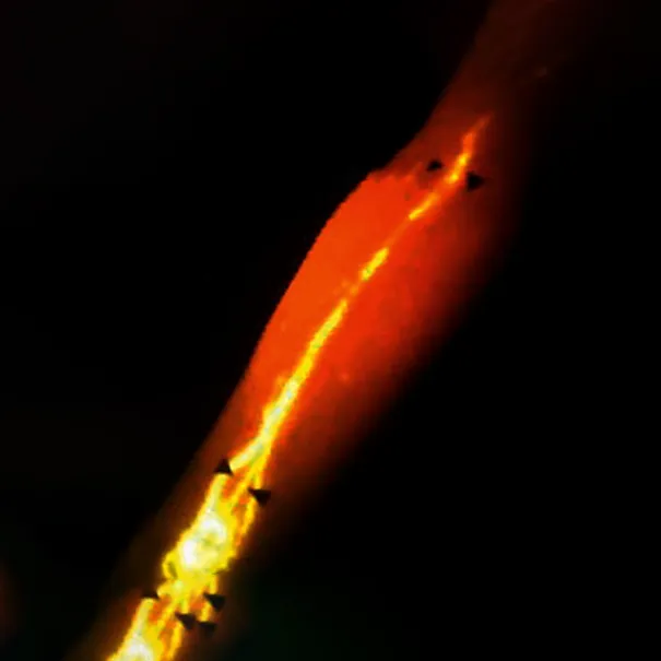 Is Chi real? Explore the radioactive isotope study from Necker Hospital and the 11th-century Mercury Test that proved the existence of acupuncture meridians.