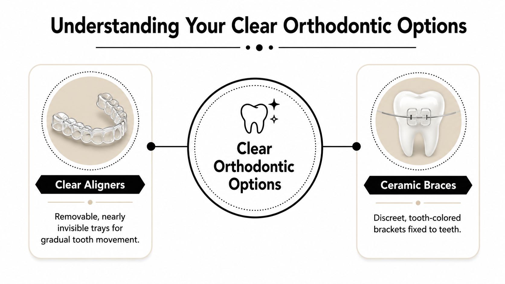 An infographic comparing clear aligners and ceramic braces as two popular options for discreet orthodontic treatment.