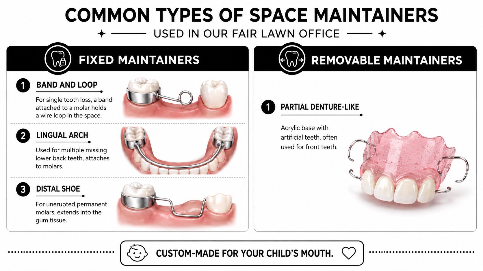 A dental infographic detailing various types of fixed and removable space maintainers used for children's oral health.