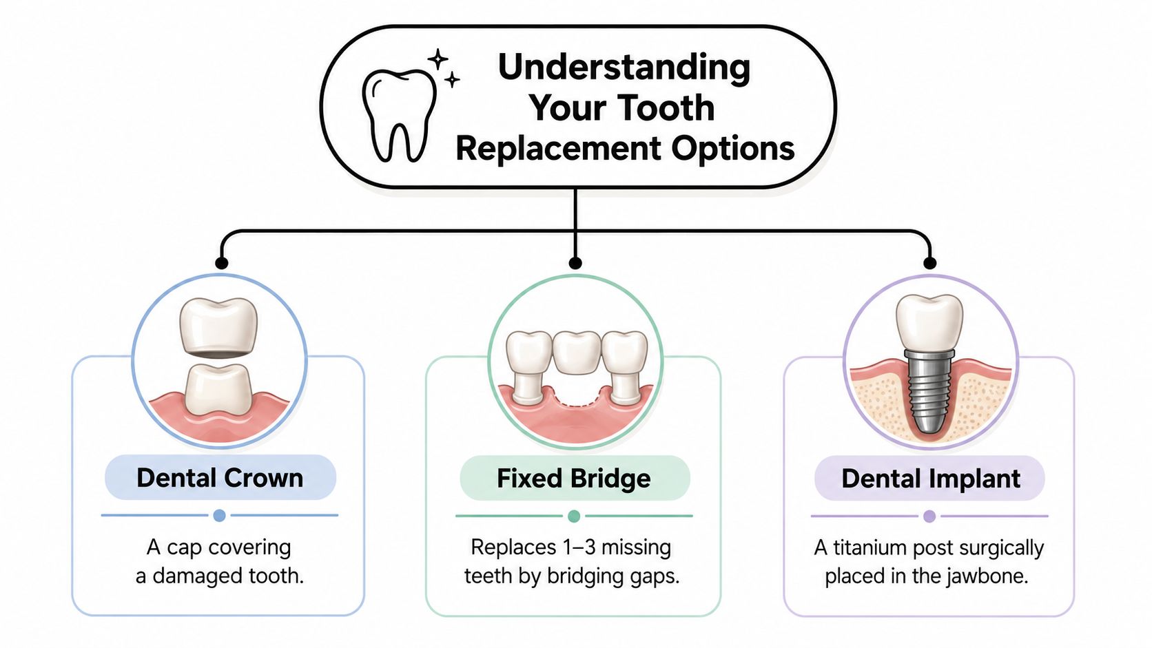 An infographic illustrating three common dental restoration options: dental crown, fixed bridge, and dental implant.