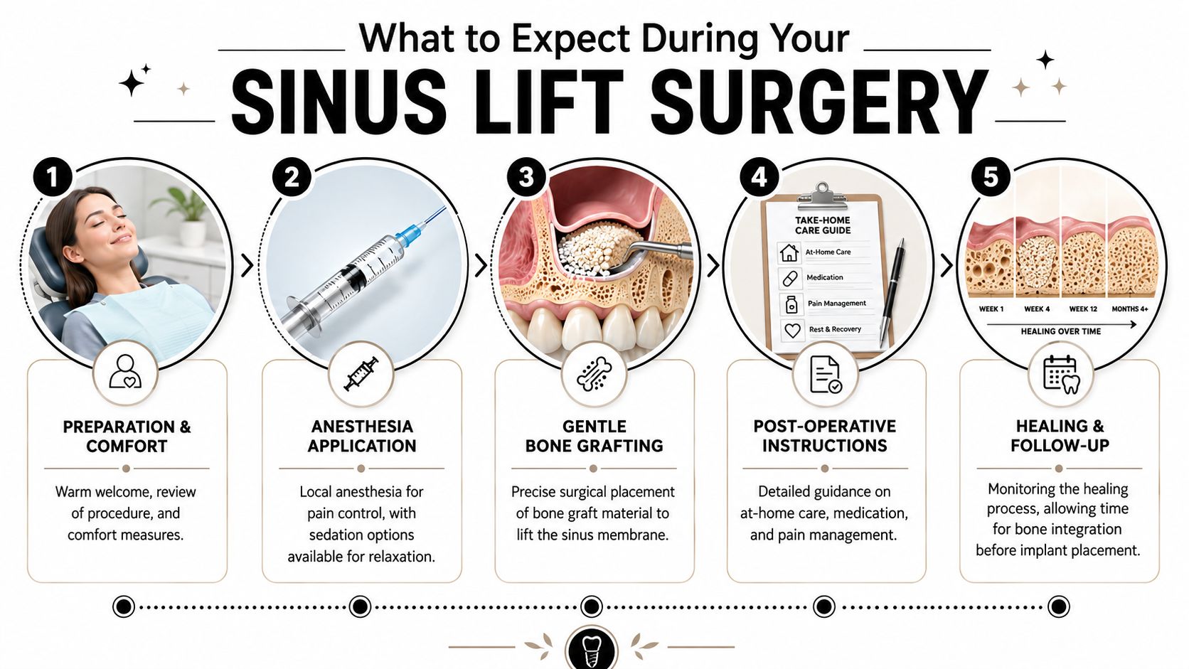 A step-by-step infographic illustrating the sinus lift surgery process from preparation to final healing and recovery.