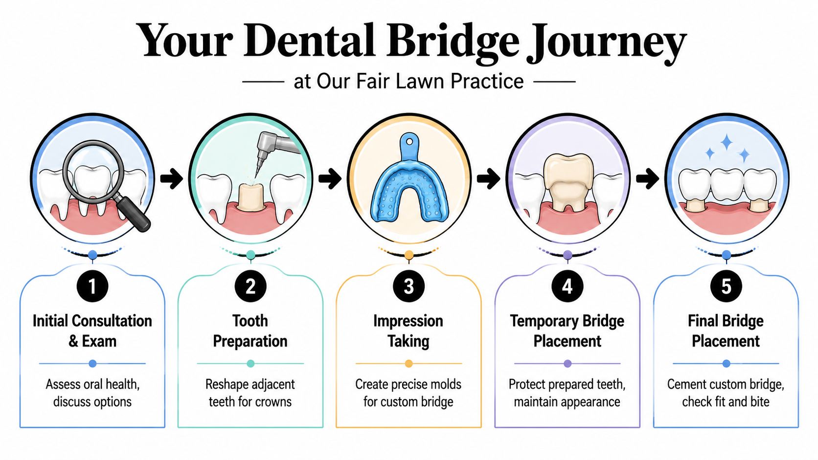 A five-step infographic illustrating the dental bridge procedure, from initial consultation to final bridge placement.