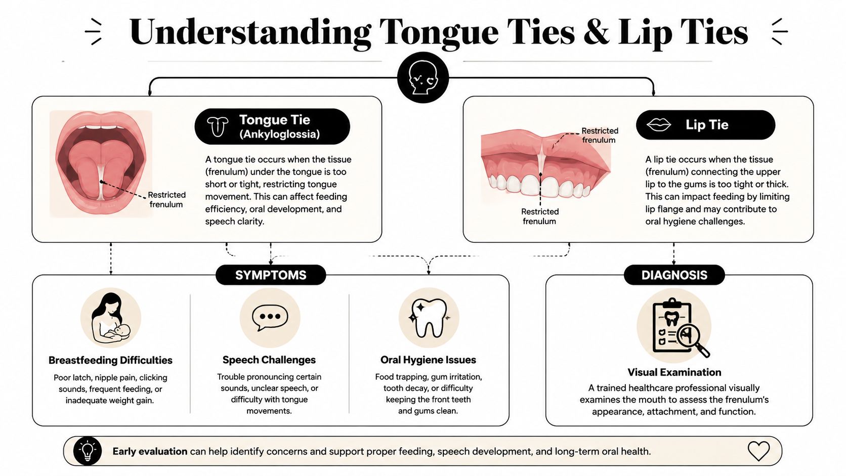 An infographic explaining tongue and lip ties, their symptoms, and the diagnosis process for oral health.