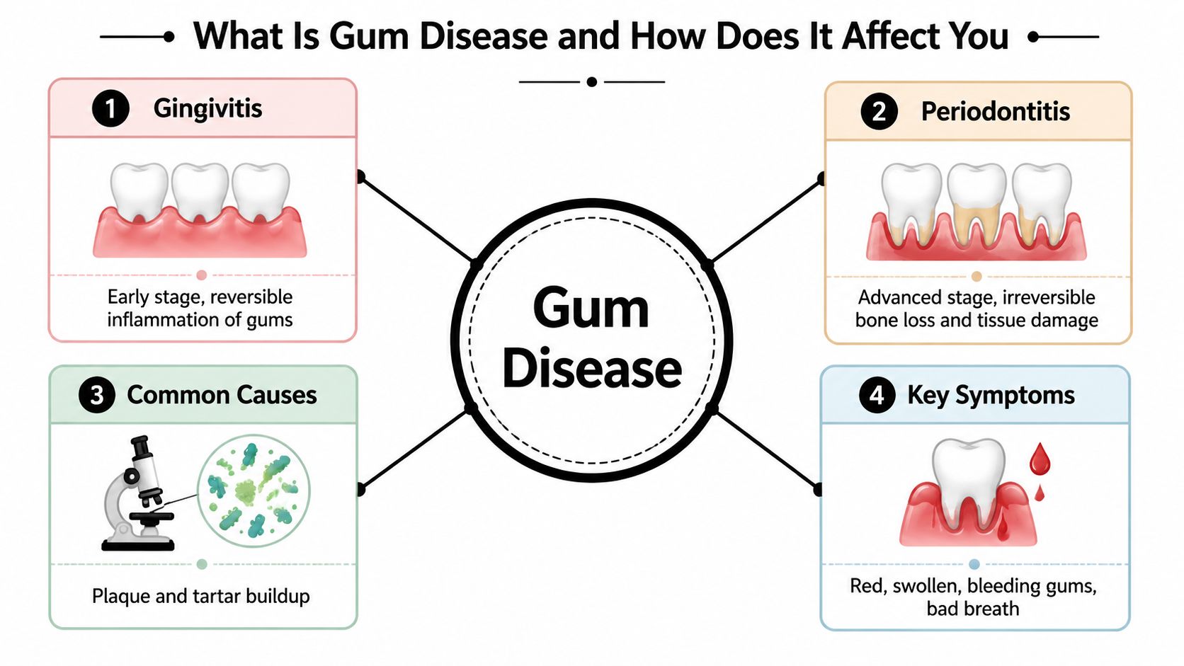 An infographic showing the stages, causes, and symptoms of gum disease including gingivitis and periodontitis.
