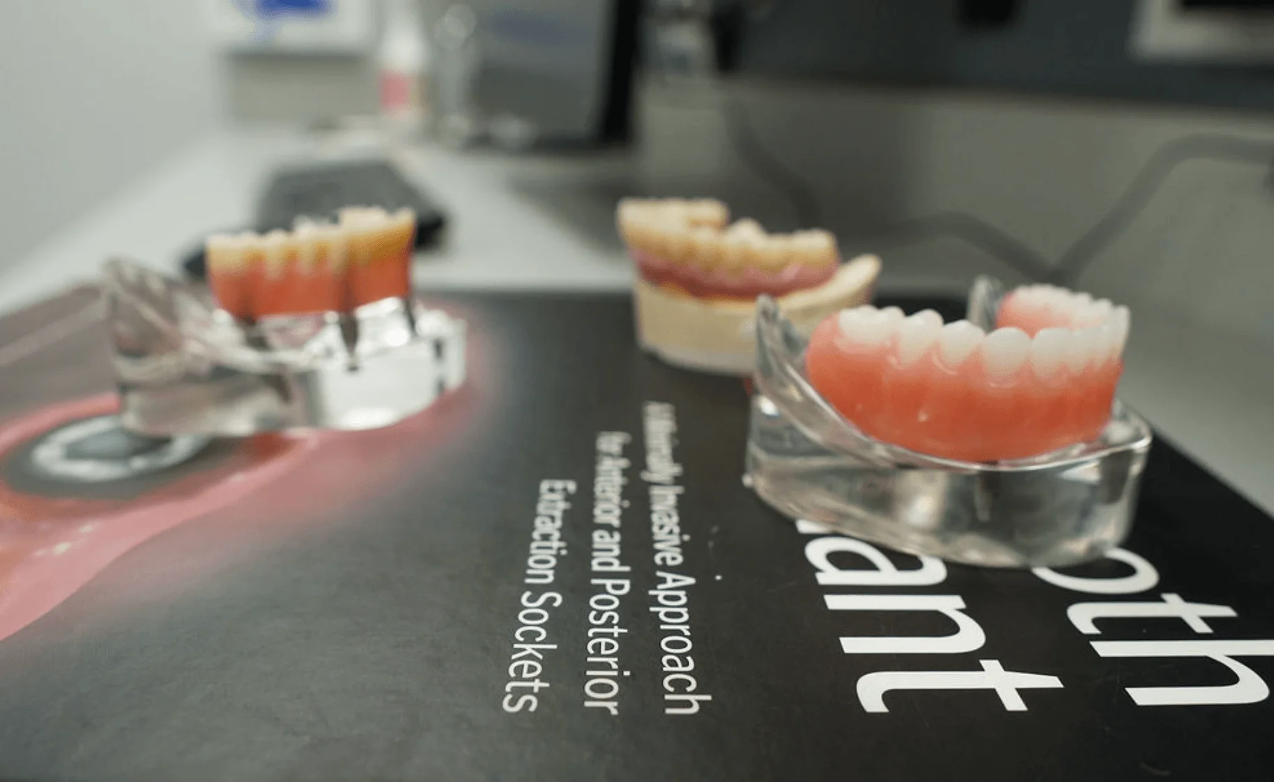 Dental models showing dental implants and dentures